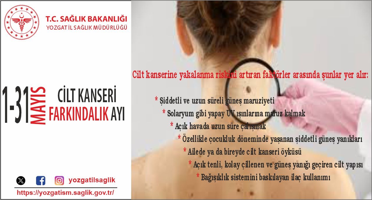 Yozgat İl Sağlık Müdürlüğü, Cilt Kanseri Farkındalık Ayı kapsamında yaptığı