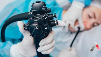 Yozgat Şehir Hastanesi, hastaların konforunu artırmak amacıyla endoskopi ve kolonoskopi