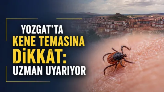 Yozgat'ta yaz aylarının gelmesiyle çocukların açık alanlarda geçirdiği süre artarken,