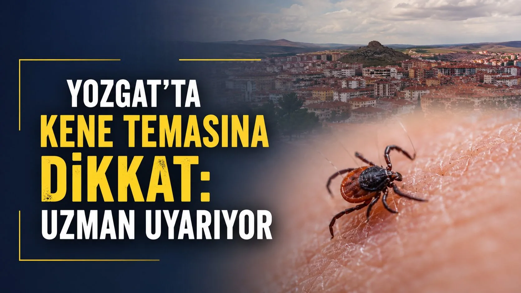 Yozgat'ta yaz aylarının gelmesiyle çocukların açık alanlarda geçirdiği süre artarken,